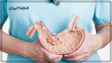 مصرف زیاد نمک خطر ابتلا به سرطان معده