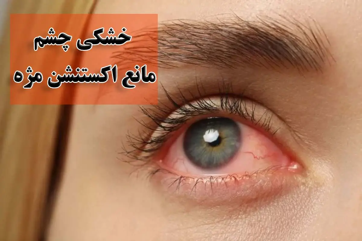 خشکی چشم، مانع اکستنشن مژه