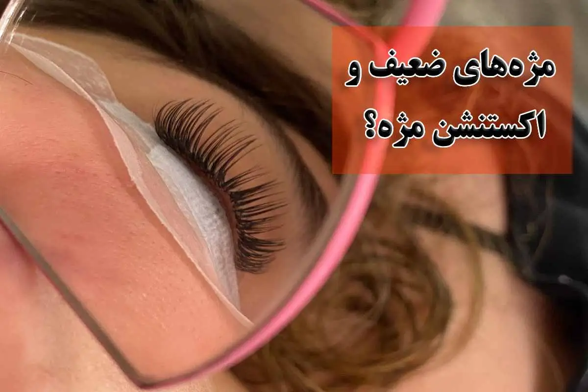 مژه‌ های ضعیف و کم‌ پشت
